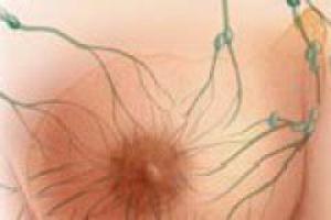 Фиброзно-кистозная мастопатия молочной железы: что важно знать о ней?